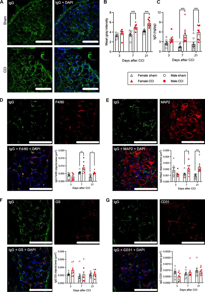 Waggoner Lab (@labwaggoner) on Twitter photo Nerve injury promotes IgG secretion from B cells, activating Fc gamma receptors in the dorsal root ganglia and spinal cord, leading to pain in mice <a href="/ScienceTM/">Science Translational Medicine</a> <a href="/DrPeterGrace/">Peter Grace, Ph.D.</a> <a href="/MJLacagnina/">Michael Lacagnina</a>
science.org/doi/10.1126/sc… Nerve injury promotes IgG secretion from B cells, activating Fc gamma receptors in the dorsal root ganglia and spinal cord, leading to pain in mice <a href="/ScienceTM/">Science Translational Medicine</a> <a href="/DrPeterGrace/">Peter Grace, Ph.D.</a> <a href="/MJLacagnina/">Michael Lacagnina</a>
science.org/doi/10.1126/sc…