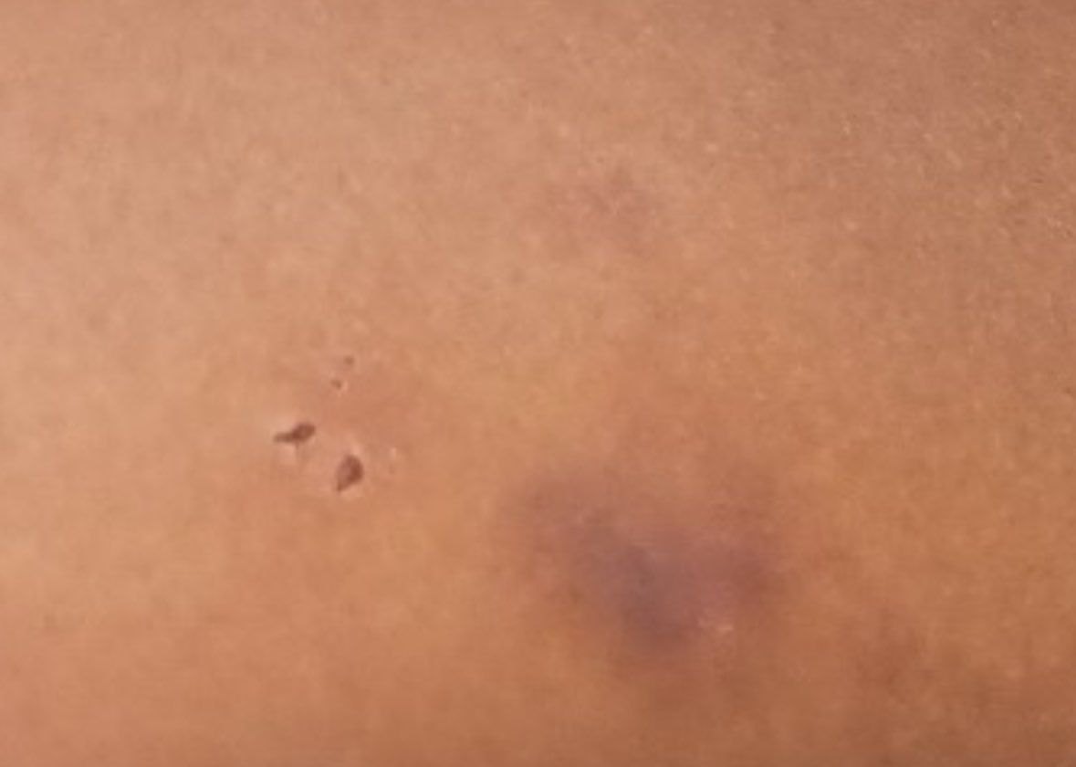 !REALITY WARNING!

Today’s petition for a Restraining Order against the MPS employee/(alleged)child abuser was granted by the courts!   Tomorrow, the world will see the rest of the photos, and have the opportunity to