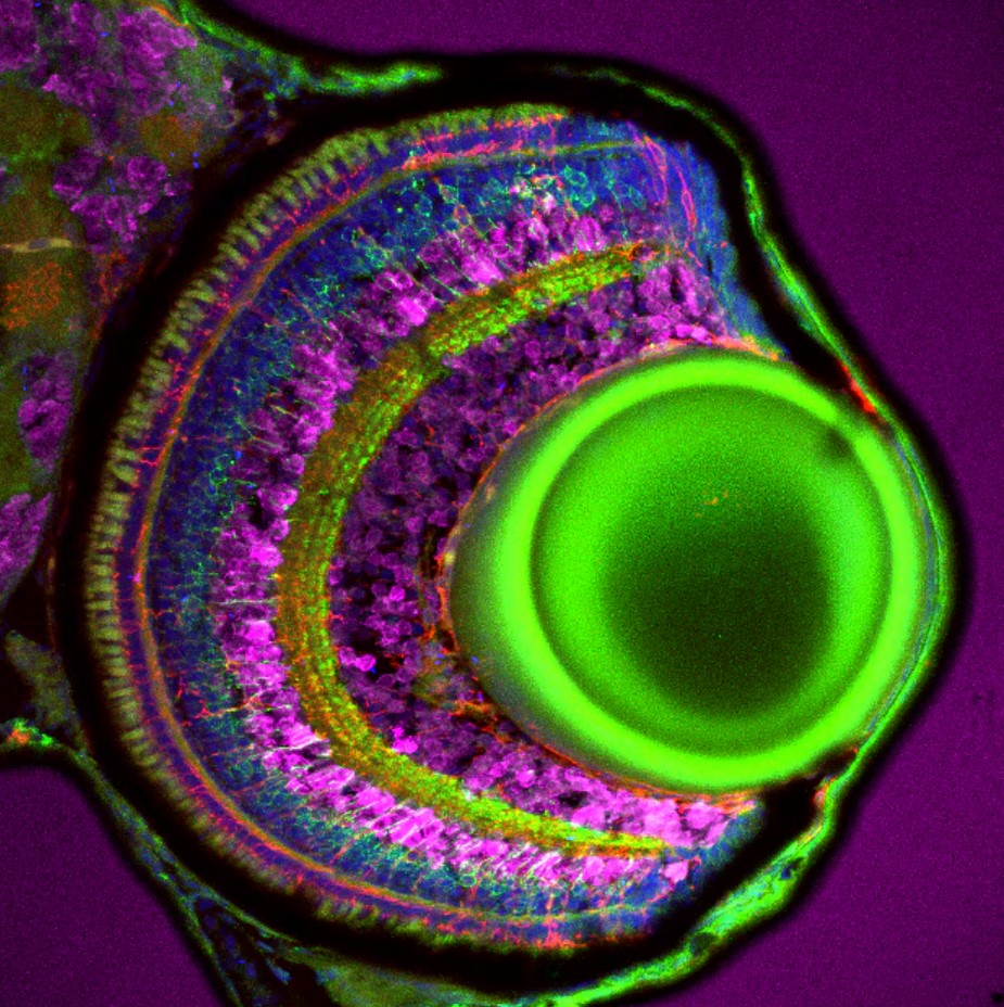 StainsFile's tweet image. Boost your immunofluorescence (IF) techniques in zebrafish retinae! 🐟 

@NJaroszynska from @MacDonald_Lab at @UCLeye shares a comprehensive review of IF steps, with tips for any tissue, in this @Proteintech blog. 

Check it out: bit.ly/479XKO4
