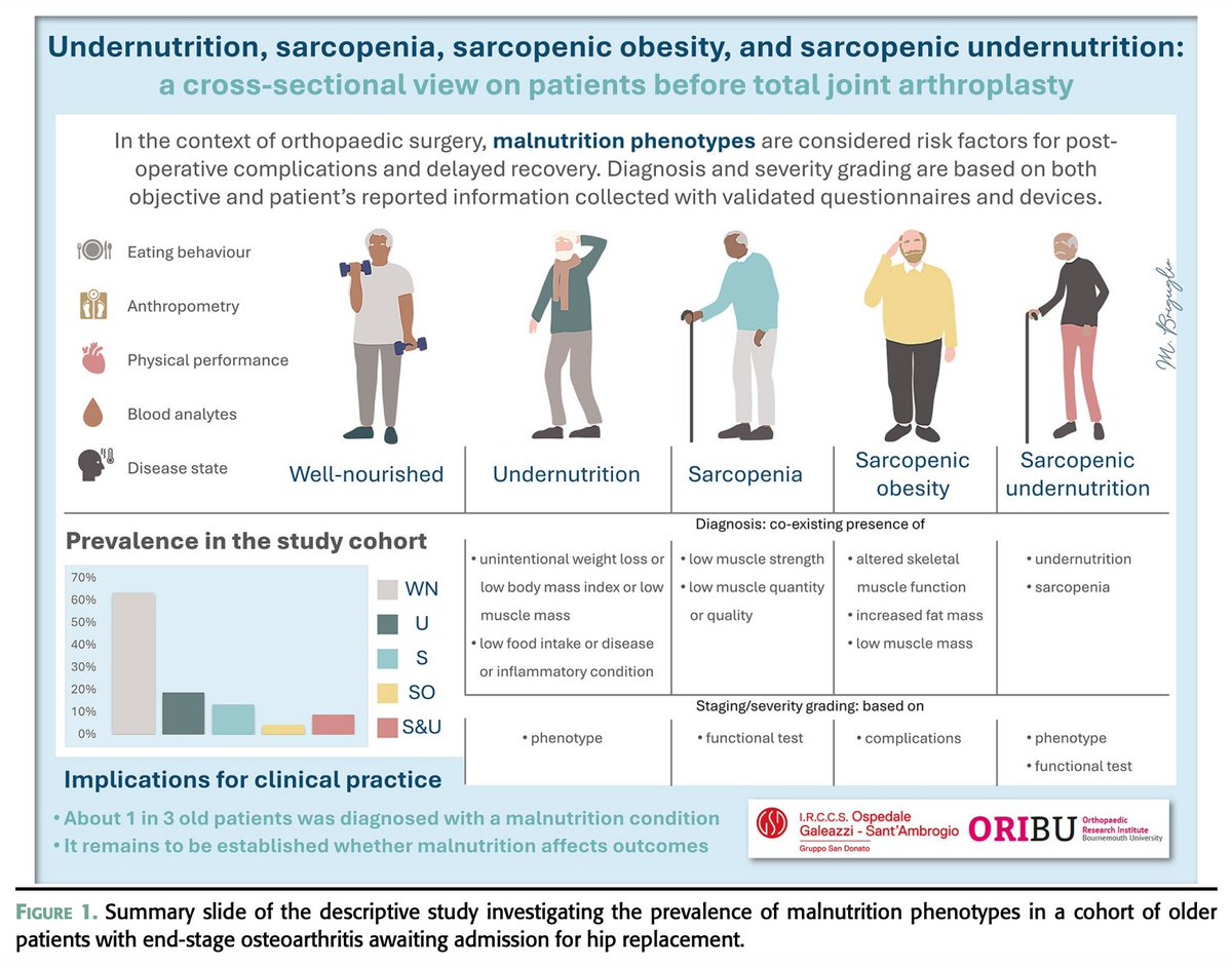 Latest paper with <a href="/BriguglioMatteo/">Matteo Briguglio</a> &amp; Italian colleagues just published in <a href="/ONJonline/">Orthopaedic Nursing</a> 

-> Undernutrition, Sarcopenia, Sarcopenic Obesity, and Sarcopenic Undernutrition A Cross-sectional View on Patients Before Hip Replacement.

journals.lww.com/orthopaedicnur…