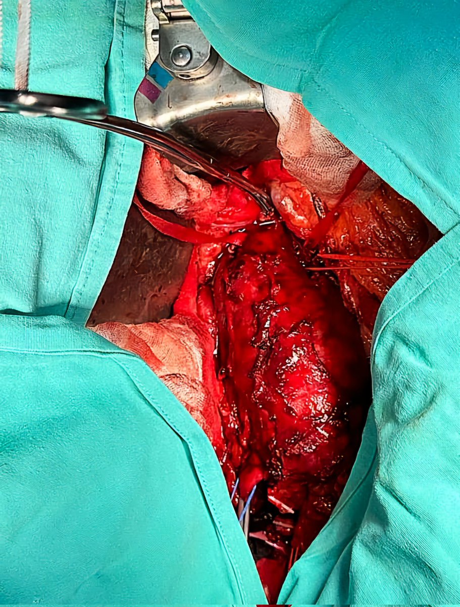 Necio Lizola MD tweet media