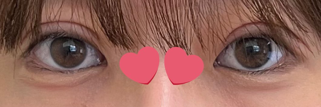 ptiptiman's tweet photo. 明日で修正して２週間🌟
まだまだ目元濃いけど目頭から二重の線があるの良すぎる😭😭 https://t.co/hIr4m5jLUX