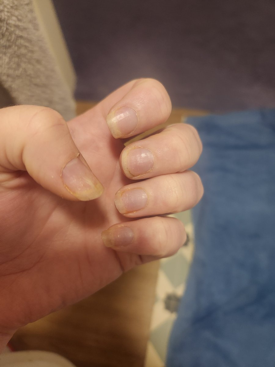 camp13771's tweet photo. nails need a good clean up and so start pigging away and help me low life's https://t.co/o3ga2MnvEW