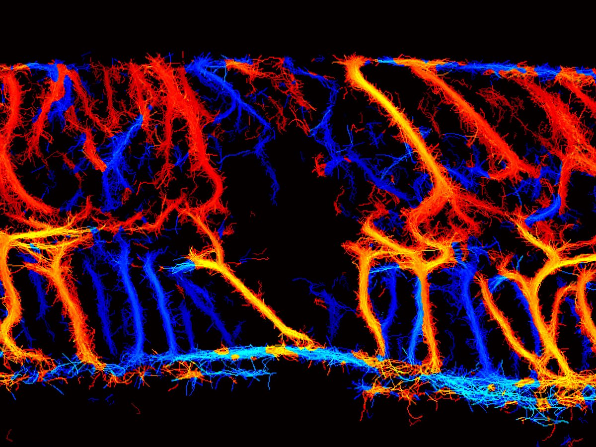 ScienceMagazine's tweet image. Two measurements of blood flow at the site of traumatic #SpinalCord injury in people and rats could be used to define injury severity and functional recovery, according to a new @ScienceTM study. scim.ag/8nO