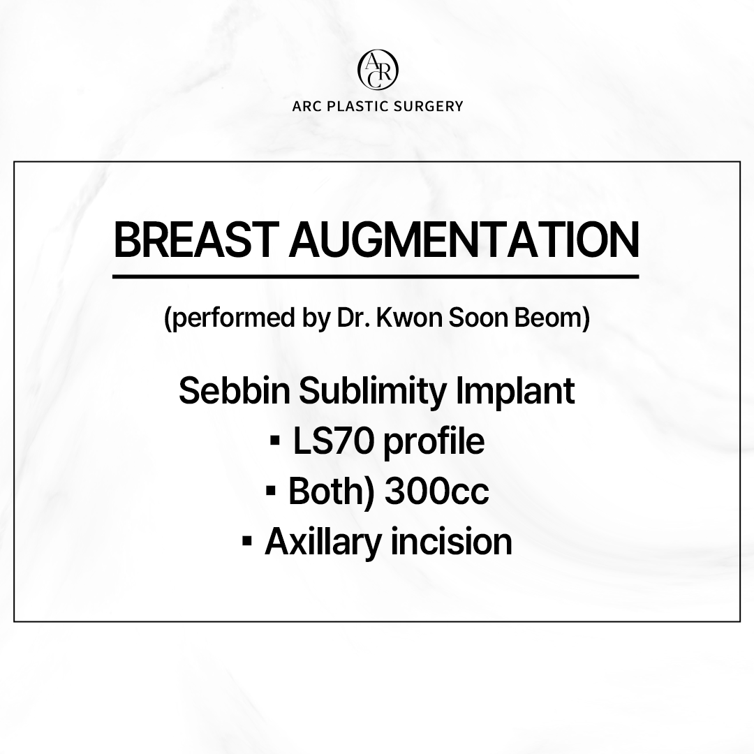 dr_kwonsoonbeom's tweet photo. [FINE ARC]
Breast Augmentation Surgery
***********
Sebbin Sublimity Implant
: LS70 Profile
- Both) 300cc
- Axillary incision
***********
#arcplasticsurgery #drkwonsoonbeom #koreaplasticsurgery #아크성형외과 #アーク整形外科 
#breastaugmentation https://t.co/OGMsXKK5zp