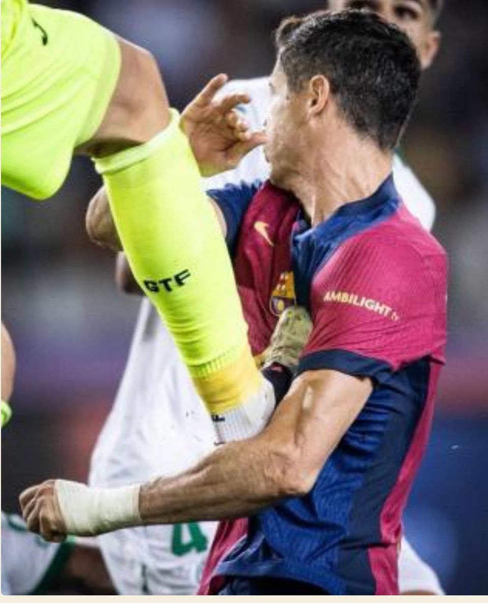 porteranunez's tweet photo. Si no tiene cuidado el polaco, volverán a sancionarlo por tocarse la nariz. Reincidente, 12 partidos. https://t.co/OkOmoYDed4