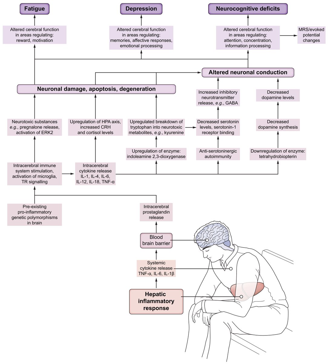 JHepatology's tweet photo. Assessment of fatigue and its impact in chronic liver disease

Read it here👉https://t.co/6Jg2Fp4YwR

#LiverTwitter https://t.co/dwPHpsi0bc