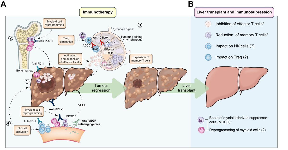 Immunotherapy for hepatocellular carcinoma

➡️The next evolution in expanding access to liver transplantation

Read it here👉journal-of-hepatology.eu/article/S0168-…

<a href="/MichaelLiMD/">Michael Li, MD, MPH</a>
#LiverTwitter