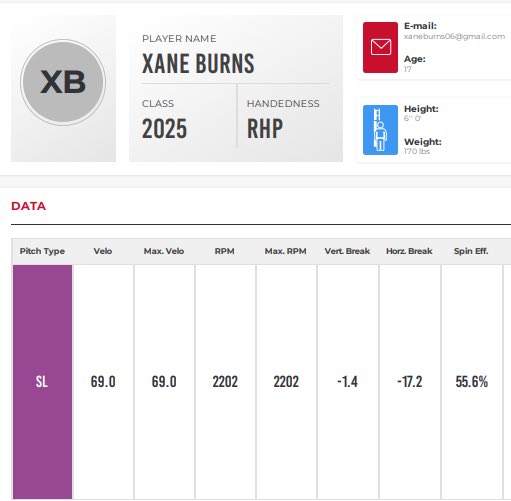 Brett Washburn (@washburnbrett) on Twitter photo Let the sweeper sweep <a href="/XaneBurns/">Xane Burns</a>! Another guy who can manipulate a baseball in the ‘25 class!
If you want more info, let me know!
<a href="/WildKatBSB/">WildKat Baseball</a> <a href="/northside_club/">Northside Baseball Club</a> Let the sweeper sweep <a href="/XaneBurns/">Xane Burns</a>! Another guy who can manipulate a baseball in the ‘25 class!
If you want more info, let me know!
<a href="/WildKatBSB/">WildKat Baseball</a> <a href="/northside_club/">Northside Baseball Club</a>
