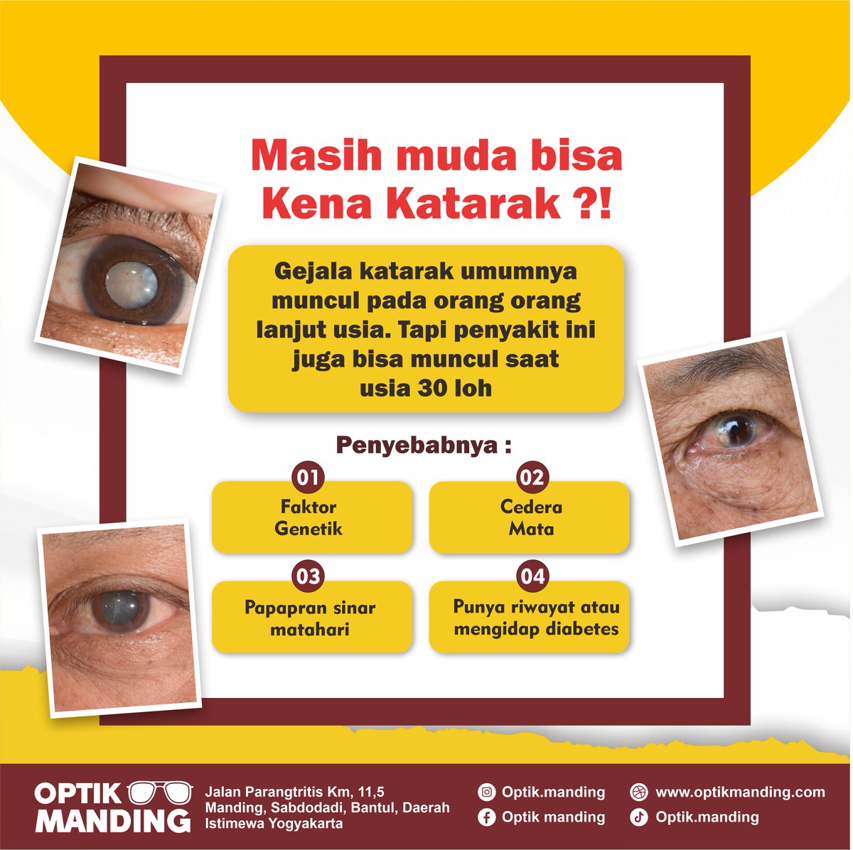 Optik_Manding's tweet photo. Lindungi matamu dari risiko katarak dengan selalu memakai kacamata hitam berkualitas saat keluar rumah! Pastikan kacamata yang kamu pilih memiliki perlindungan UV yang maksimal. Jaga kesehatan mata sejak dini, demi masa depan penglihatan yang lebih cerah. 🌞👁️ https://t.co/n0HafNLm7H