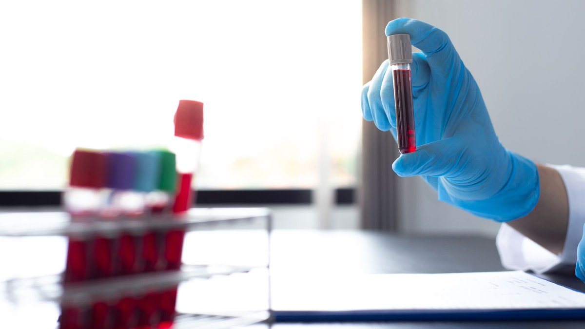 Brigham and Women’s Research (@brighamresearch) on Twitter photo Research Spotlight: Addressing Challenges to Clinical Translation of Biomarkers of Aging Tools buff.ly/3XXgA7U <a href="/jpoganik/">Jesse Poganik</a> <a href="/gladyshev_lab/">Gladyshev Lab</a> <a href="/agingbiomarkers/">Biomarkers of Aging Consortium</a> Research Spotlight: Addressing Challenges to Clinical Translation of Biomarkers of Aging Tools buff.ly/3XXgA7U <a href="/jpoganik/">Jesse Poganik</a> <a href="/gladyshev_lab/">Gladyshev Lab</a> <a href="/agingbiomarkers/">Biomarkers of Aging Consortium</a>