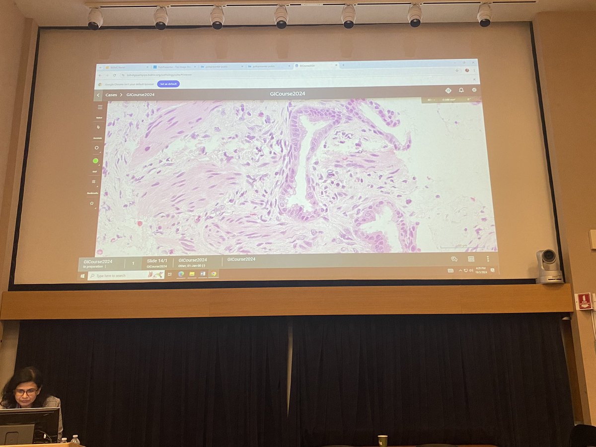 Lisha Wang, MD, PhD (@lishawang9) on Twitter photo Big thanks to Drs. Montgomery, Gonzalez, Vyas, and Deshpande for an engaging and insightful GI pathology case conference! Great discussions on this challenging case: Would you call it pancreatic cancer on a biopsy❓❓<a href="/LizMontgomeryMD/">Elizabeth Montgomery, MD</a> <a href="/RaulSGonzalezMD/">Raul S. Gonzalez, MD</a> <a href="/Vik_deshpandeMD/">Vikram Deshpande</a> <a href="/Mvgs1706/">Monika Vyas</a> Big thanks to Drs. Montgomery, Gonzalez, Vyas, and Deshpande for an engaging and insightful GI pathology case conference! Great discussions on this challenging case: Would you call it pancreatic cancer on a biopsy❓❓<a href="/LizMontgomeryMD/">Elizabeth Montgomery, MD</a> <a href="/RaulSGonzalezMD/">Raul S. Gonzalez, MD</a> <a href="/Vik_deshpandeMD/">Vikram Deshpande</a> <a href="/Mvgs1706/">Monika Vyas</a>