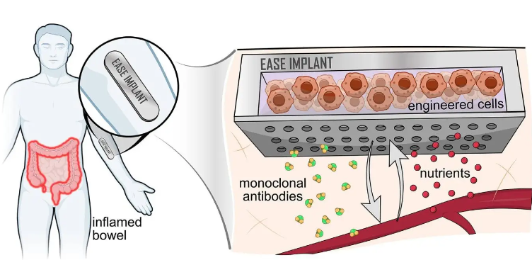 GFarrugiaMD's tweet photo. A new ARPA-H award will enable Mayo to lead efforts to develop an implantable device that will revolutionize treatment for inflammatory bowel disease. Read more: https://t.co/Fl8enaBDGB https://t.co/pQ9GNabCbq