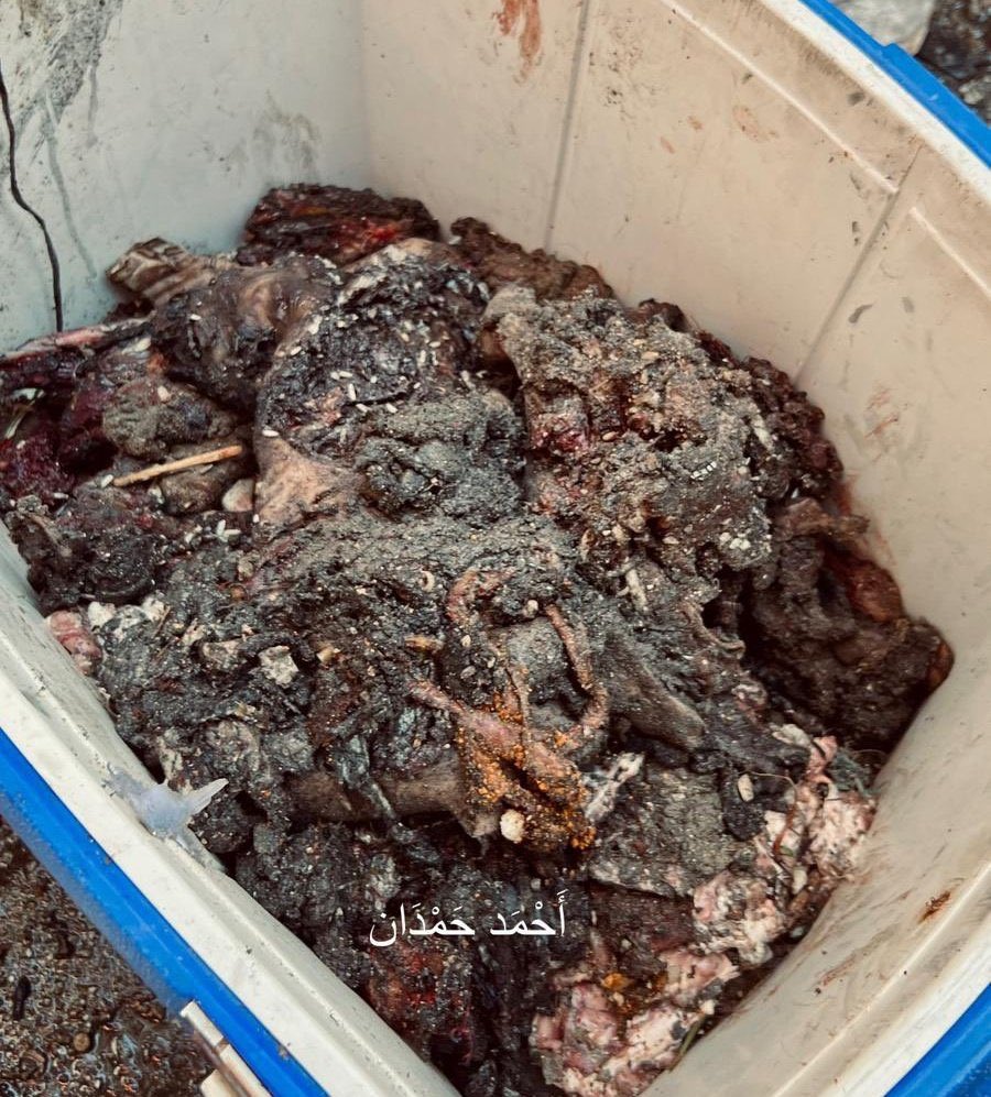 Burada bir çocuğun eli, bir kadının bacağı ve bir erkeğin kafasının parçaları var..!!

- Bu fotoğraf acizliğimizin göstergesidir.