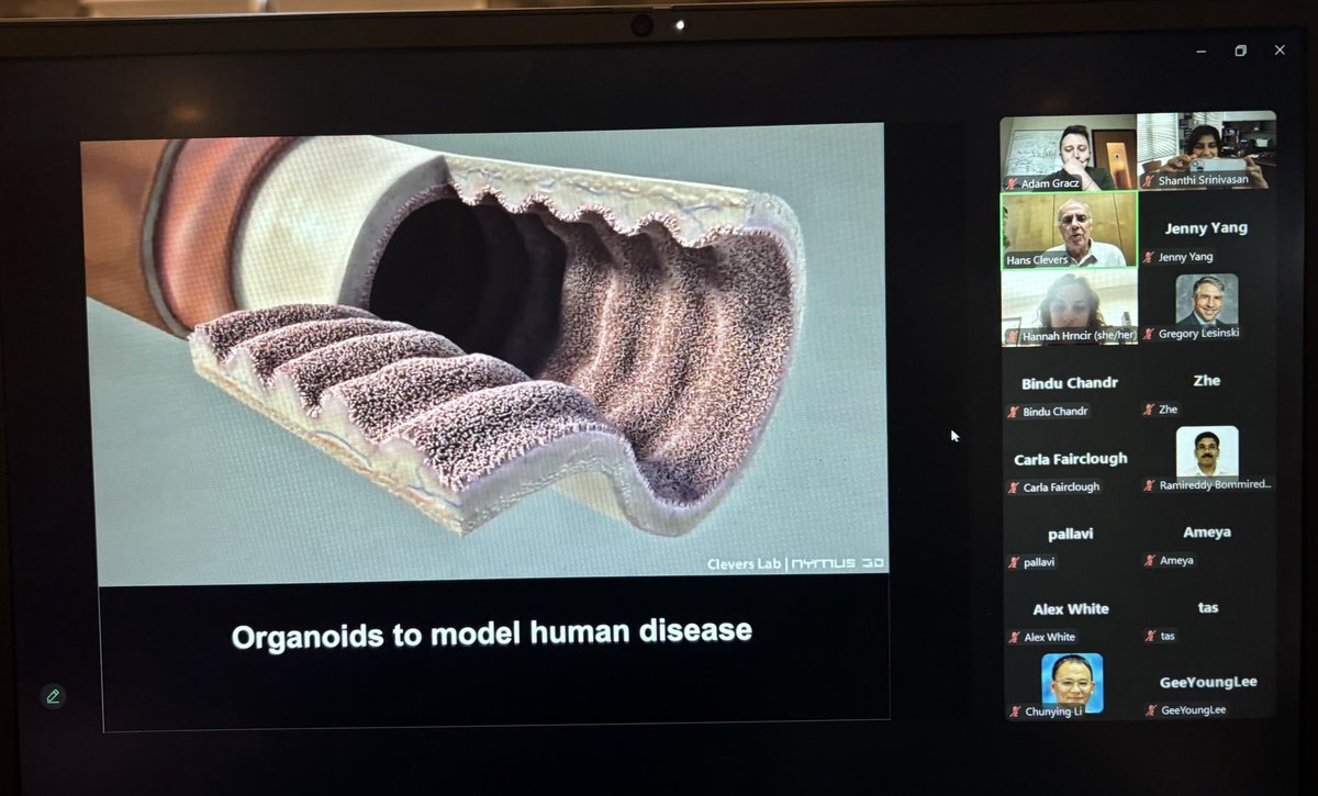 Shanthi Srinivasan, MD (@ssrinivasanmd) on Twitter photo Fascinating talk by <a href="/HansClevers/">Hans Clevers</a> as the opening seminar for EDDI series this year! Thank you @graczlab for organizing EDDI! Great attendance! <a href="/WinshipAtEmory/">Winship Cancer Institute of Emory University</a> <a href="/GSU_Biology/">Georgia State Biology</a> <a href="/EmoryGastroHep/">Emory Gastroenterology and Hepatology Fellowship</a> <a href="/EmoryPediatrics/">Emory Dept of PEDS</a> GI <a href="/EmoryDeptofMed/">Emory Department of Medicine</a> Fascinating talk by <a href="/HansClevers/">Hans Clevers</a> as the opening seminar for EDDI series this year! Thank you @graczlab for organizing EDDI! Great attendance! <a href="/WinshipAtEmory/">Winship Cancer Institute of Emory University</a> <a href="/GSU_Biology/">Georgia State Biology</a> <a href="/EmoryGastroHep/">Emory Gastroenterology and Hepatology Fellowship</a> <a href="/EmoryPediatrics/">Emory Dept of PEDS</a> GI <a href="/EmoryDeptofMed/">Emory Department of Medicine</a>