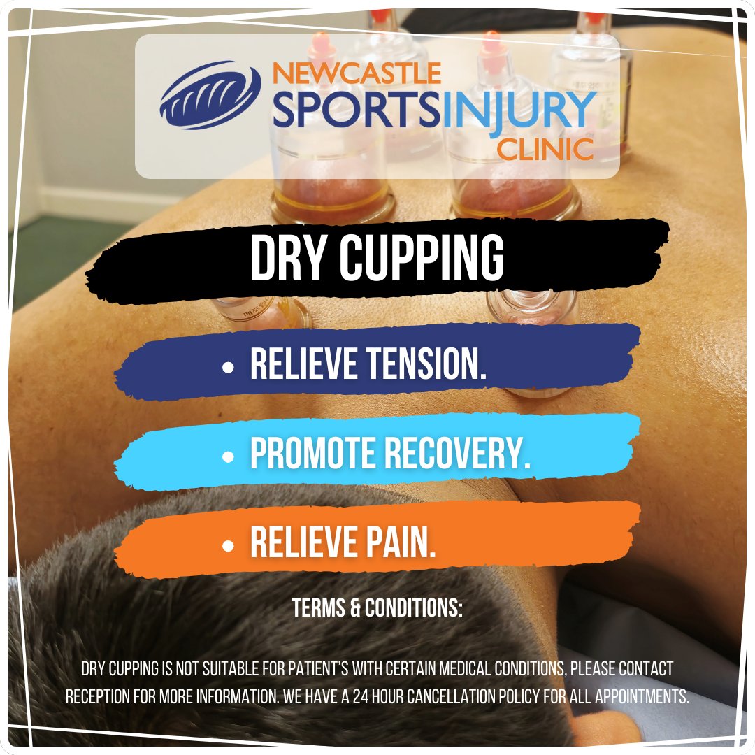 If you live in Newcastle Upon Tyne and want give our dry cupping treatment a try, we are offering it now at our Saville Place clinic in the city centre!