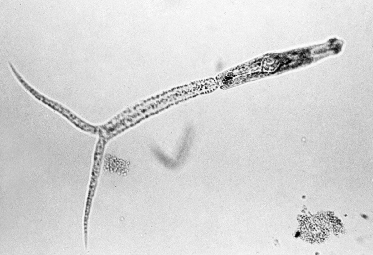 Naturalake's tweet photo. Swimmer’s Itch is an allergic reaction to parasites that cause severe skin infections in humans who engage in water activities. There are ways to help prevent this issue. Discover more about this issue by checking out our blog below! 

Read more: https://t.co/KwIUjlURiJ https://t.co/36jUVShPGy