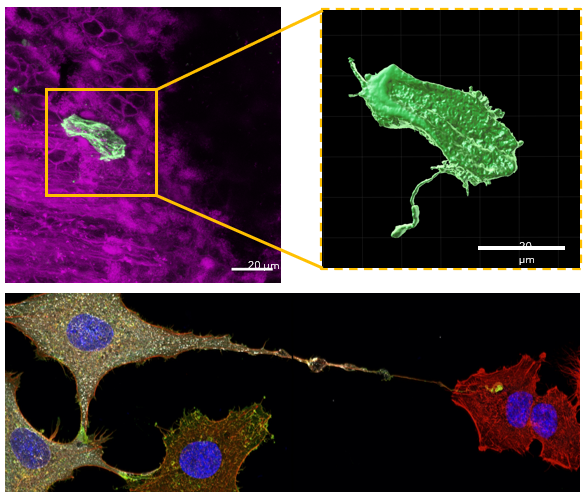 Hutchinson Lab (@cvrhutchinson) on Twitter photo 🚨New preprint🚨
In <a href="/DanielWeirIAV/">Daniel Weir</a>'s first first-author paper, he shows that tubular structures connect #influenza virus infected cells within the lung. It induces these by driving the infected cell into apoptosis, allowing the virus to spread covertly to new cells 🦠🕵️ 🚨New preprint🚨
In <a href="/DanielWeirIAV/">Daniel Weir</a>'s first first-author paper, he shows that tubular structures connect #influenza virus infected cells within the lung. It induces these by driving the infected cell into apoptosis, allowing the virus to spread covertly to new cells 🦠🕵️
