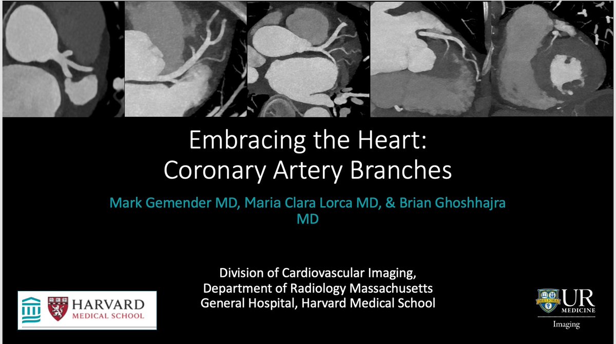 MGH Radiology Chiefs (@mghradchiefs) on Twitter photo Proud of our all-star ๐ resident <a href="/MarkGemender/">Mark Gemender</a> for delivering an outstanding talk on "Embracing the โฅ๏ธ: Coronary Artery Branches" at <a href="/NASCISociety/">NASCI</a> #NASCI24! Joined by <a href="/MariaClaraLorca/">MariaClaraLorcaMD</a> & <a href="/ghoshhajra/">Brian with the Good Dictations</a> with the support of <a href="/SandeepHedgire/">Sandeep Hedgire</a> and our fantastic CV division. Proud of our all-star ๐ resident <a href="/MarkGemender/">Mark Gemender</a> for delivering an outstanding talk on "Embracing the โฅ๏ธ: Coronary Artery Branches" at <a href="/NASCISociety/">NASCI</a> #NASCI24! Joined by <a href="/MariaClaraLorca/">MariaClaraLorcaMD</a> & <a href="/ghoshhajra/">Brian with the Good Dictations</a> with the support of <a href="/SandeepHedgire/">Sandeep Hedgire</a> and our fantastic CV division.