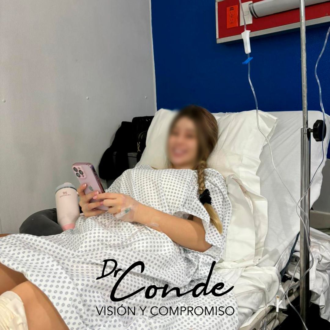 Como parte de mis actividades del fin de semana, les comparto que realicé una lipoescultura con lipotransferencia a glúteos, logrando moldear el contorno corporal de mi paciente de manera precisa y con resultados excelentes.🥼💪🏻