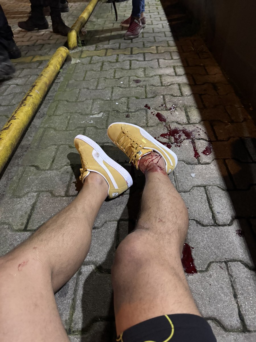 Program çıkışı ayaklarıma sıktılar son sözümüz Fenerbahçe 💛💙