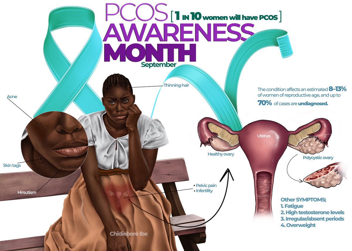 Polycystic Ovary Syndrome (PCOS) affects 1 in 10 women of reproductive age, yet many still struggle for years without a proper diagnosis. PCOS is a hormonal disorder that can cause irregular periods, weight gain, acne, excessive hair growth, and even infertility. 

But it’s more