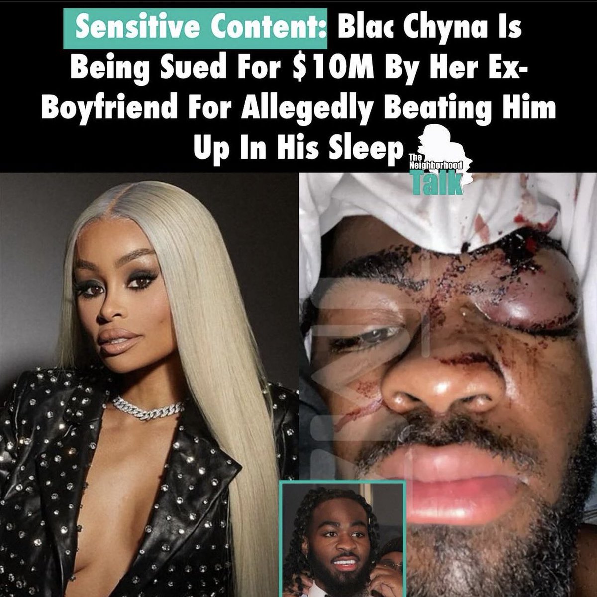 NATERERUN's tweet photo. Blac Chyna had no business dozing him like that…. Like woah https://t.co/R7AtBGKNNJ