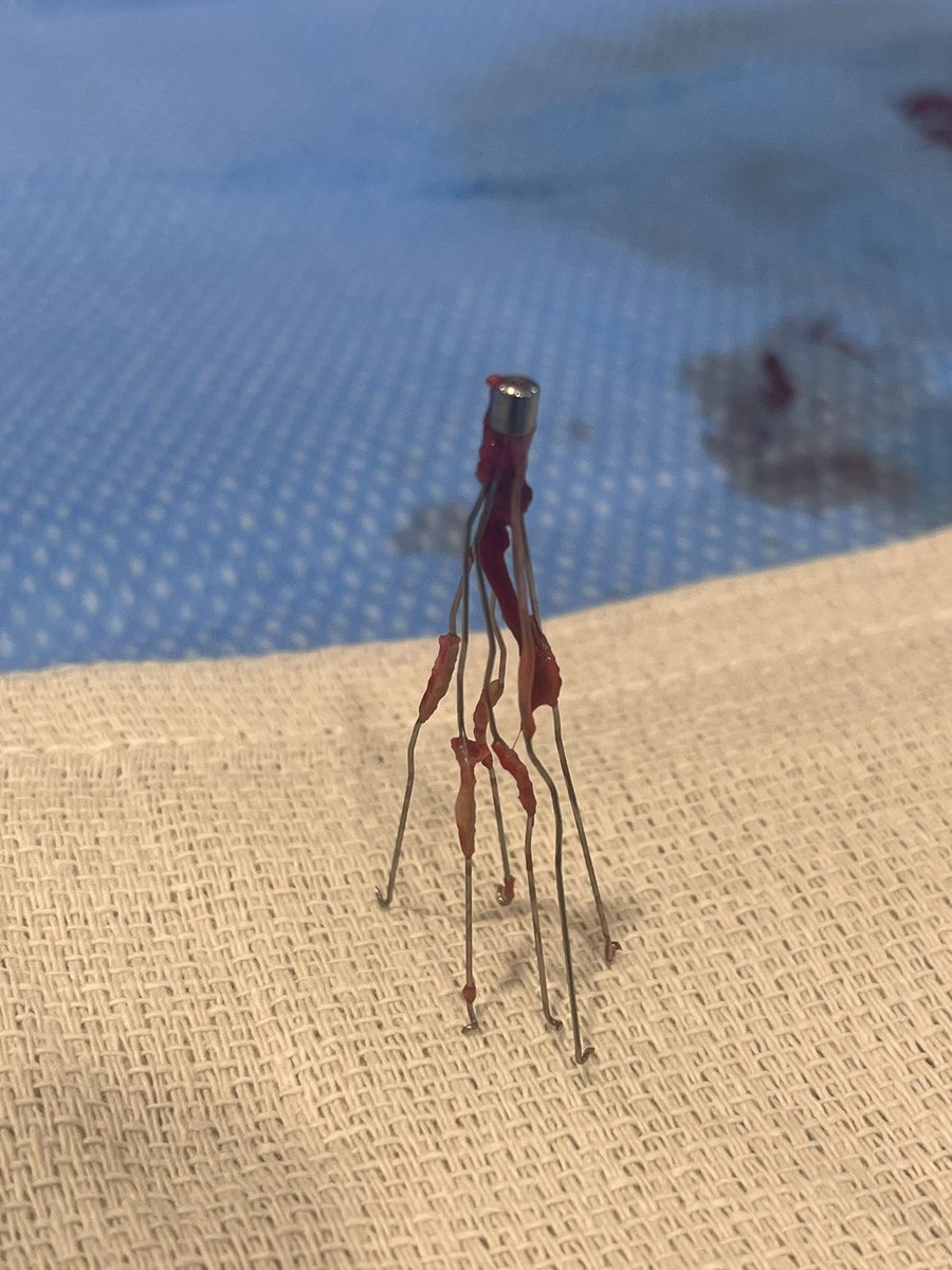 TherealDoctorJ's tweet photo. We recently removed this 24 year old greenfield using some advanced maneuvers. But this #filterout post is not about the end result…. https://t.co/OzggwCGxQb