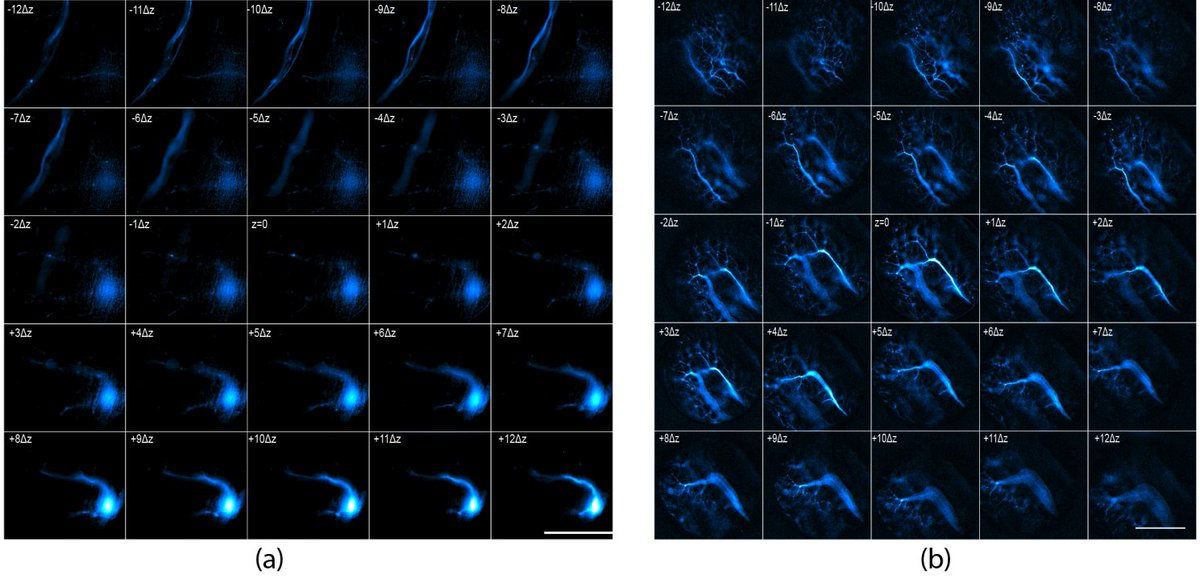 Eduardo 'Yoshi' Hirata (@edyoshikun) on Twitter photo As a proof-of-concept for neurobiological applications, we collected the lamprey motor neurons with <a href="/kfouke2/">Kaitlyn Fouke</a> and <a href="/JMorganLab/">Morgan Lab</a> and the zebrafish nervous system.
6/ As a proof-of-concept for neurobiological applications, we collected the lamprey motor neurons with <a href="/kfouke2/">Kaitlyn Fouke</a> and <a href="/JMorganLab/">Morgan Lab</a> and the zebrafish nervous system.
6/