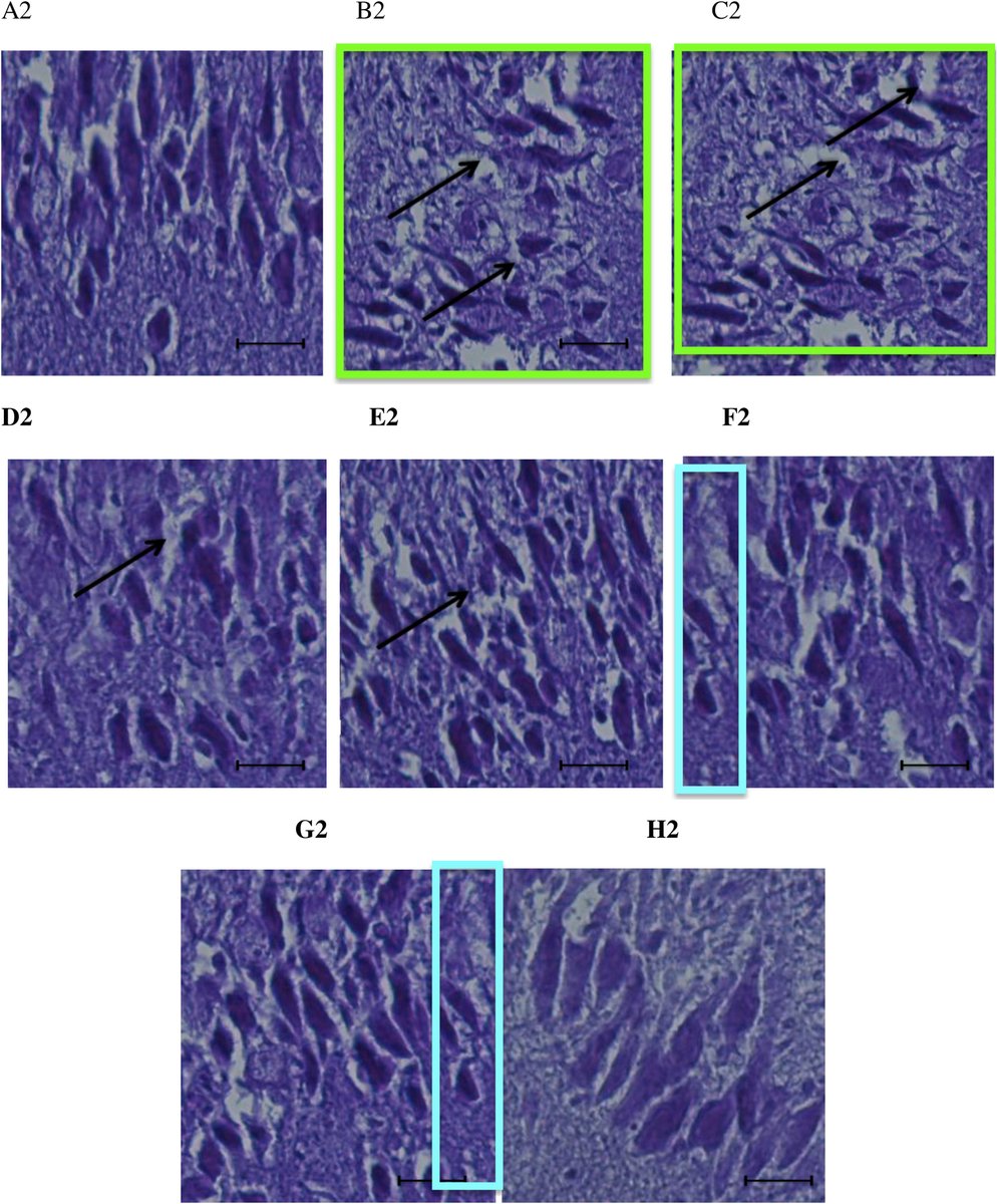 allisonrcheney's tweet photo. Found a paper with some of the most obvious image duplications I've ever seen:

https://t.co/81hba57sqy https://t.co/VIr5YAlkSw