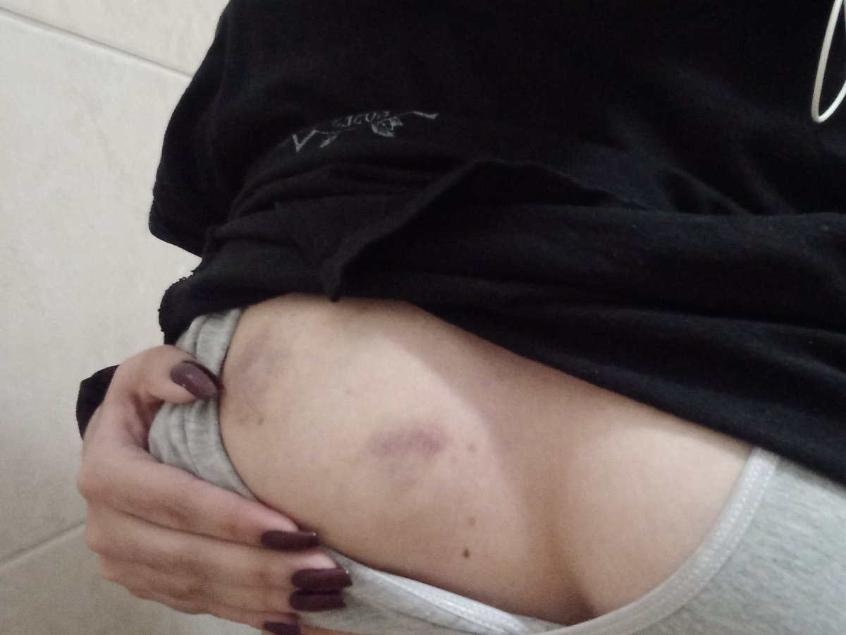 nseulfk's tweet photo. amo que me dejen marcas en las tetas 😻 https://t.co/Wk72reGUDm