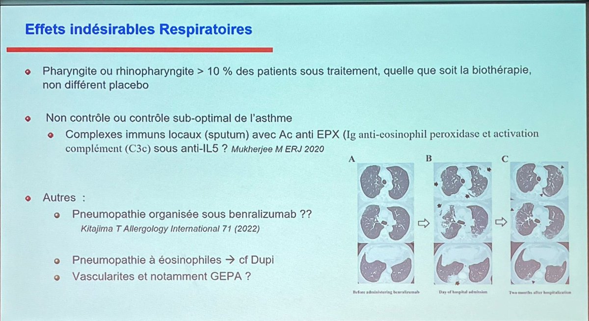 Nouveaux effets secondaires des biothérapies #jeas Reims 
Ph Bonniaud