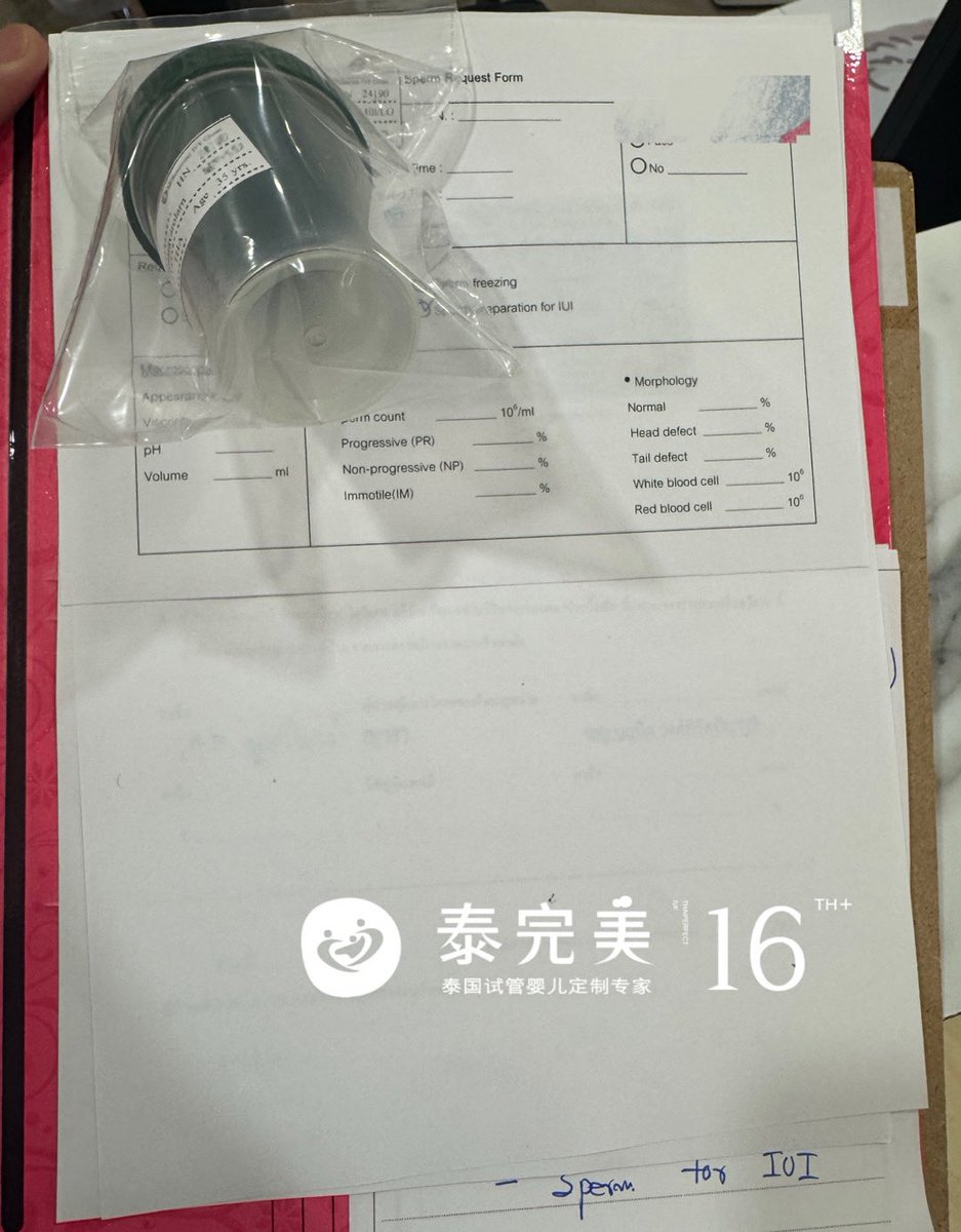 ivan611504141's tweet photo. 苏州35岁L先生开起好孕之旅👨‍🍼
一切准备就绪，准备取精🤭
#代孕 #泰完美 #同性 #男男 #夫夫  #LGBTQ #gay https://t.co/hmTXthLNIG