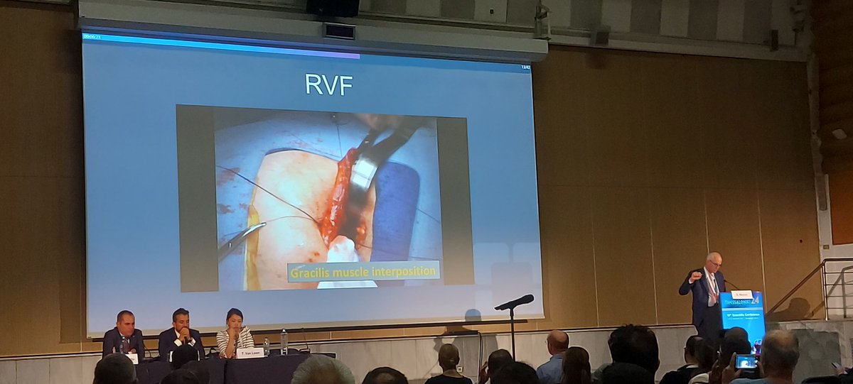 Beatriz Silva Mendes (@smendesbeatriz) on Twitter photo Just wrapped up an incredible emergency proctology session ‼️
Packed with valuable tips, tricks, and practical advice ✅️
Always learning and growing!
#SlideOfTheDay #ESCP2024
<a href="/MiguelCunhaSurg/">Miguel F. Cunha</a> <a href="/ZGaroufalia/">ZoeGaroufalia</a> <a href="/SWexner/">Steven D Wexner MD, PhD</a> <a href="/ytvanloon/">Tina van Loon</a> <a href="/nlavellaneda/">Nicolas Avellaneda</a> <a href="/pedbotel/">Pedro Botelho</a> <a href="/caterina_foppa/">Caterina Foppa</a> Just wrapped up an incredible emergency proctology session ‼️
Packed with valuable tips, tricks, and practical advice ✅️
Always learning and growing!
#SlideOfTheDay #ESCP2024
<a href="/MiguelCunhaSurg/">Miguel F. Cunha</a> <a href="/ZGaroufalia/">ZoeGaroufalia</a> <a href="/SWexner/">Steven D Wexner MD, PhD</a> <a href="/ytvanloon/">Tina van Loon</a> <a href="/nlavellaneda/">Nicolas Avellaneda</a> <a href="/pedbotel/">Pedro Botelho</a> <a href="/caterina_foppa/">Caterina Foppa</a>