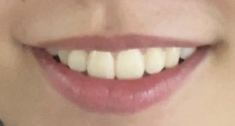 hhahnha's tweet photo. 口元が好きだったんですけど歯垢なのか連結歯で落ち込みました https://t.co/8mOXNNOAOF