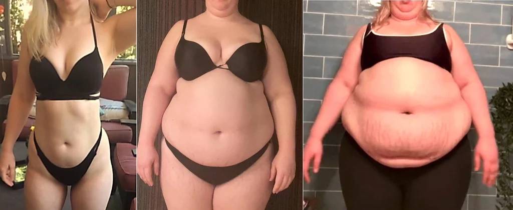 ObeseSupremacy's tweet photo. The only development you should expect is the one around your waist. Any other doesn't count! Focus only on that! The fatter the piggy the better! Pretty straightforward, eh? Even a PIGtard like you would understand that! So go on, stuff that PIGface of yours with GREASY food! https://t.co/4iySgFdyff