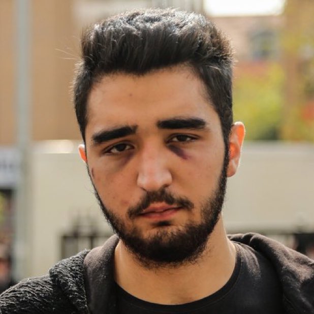 TurhanBozkurTV's tweet photo. 🛑 Aykırı Haber: “İstanbul Bakırköy’de kız arkadaşını darp edip, vatandaşları aracıyla ezmişti.

🚨 Vatandaşların üzerine araç sürdü. Hâkim lojmanından ses bombası attı.

🛑 Pompalı tüfekle ateş açtı. Hemşireye, bekçilere hakaret etti.

🛑 Kız arkadaşını darp etti. Polisleri tehdit etti.

👨‍⚖️ Hakkında açılan 9 davada hükmün açıklanmasının geri bırakılmasına karar verilen eski hâkim-savcı çocuğu Görkem Sertaç Göçmen hakkında bugüne kadar hiçbir mahkeme infaz edilebilir bir karar vermedi.”
 https://t.co/ZXQz14CydE