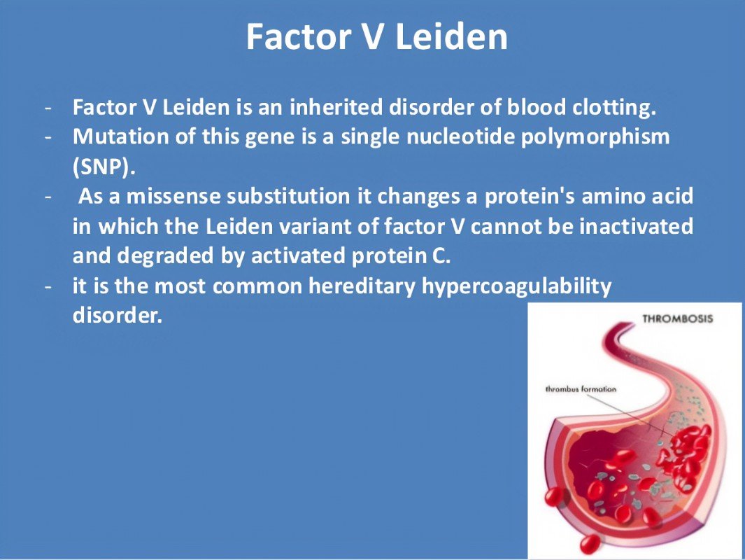 THEDAYTONDUDE's tweet photo. Just want to raise awareness of #FactorV today. I've been riddled with blood clots for 20 years now. I just had a Pulmonary Embolism a few days ago. It's not fun when your own body wants to kill itself!!! https://t.co/EecW13cjGG