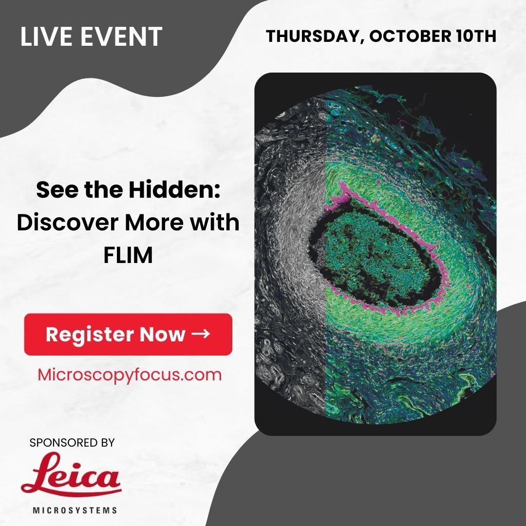BitesizeBio's tweet image. Unlock the potential of #FLIM to revolutionize your cell imaging!🧬 Join our virtual #workshop with @LeicaMicro to learn advanced techniques like phasor-based analysis, #multicolorimaging, and mapping oxygen gradients in 3D models, and more. Register Now→ buff.ly/4ey7xQn
