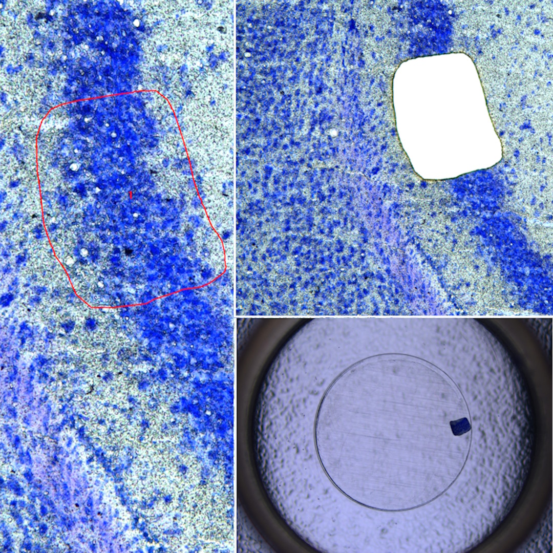 LeicaMicro's tweet photo. Find out how laser #microdissection (LMD) helps improve your analysis of DNA, RNA, proteins, lipids, metabolites, or other biomolecules extracted from, cells, tissues, plants, and other biological specimens. Just read this article to get the details: https://t.co/wAoLCYcciQ https://t.co/evpnqXrlYL