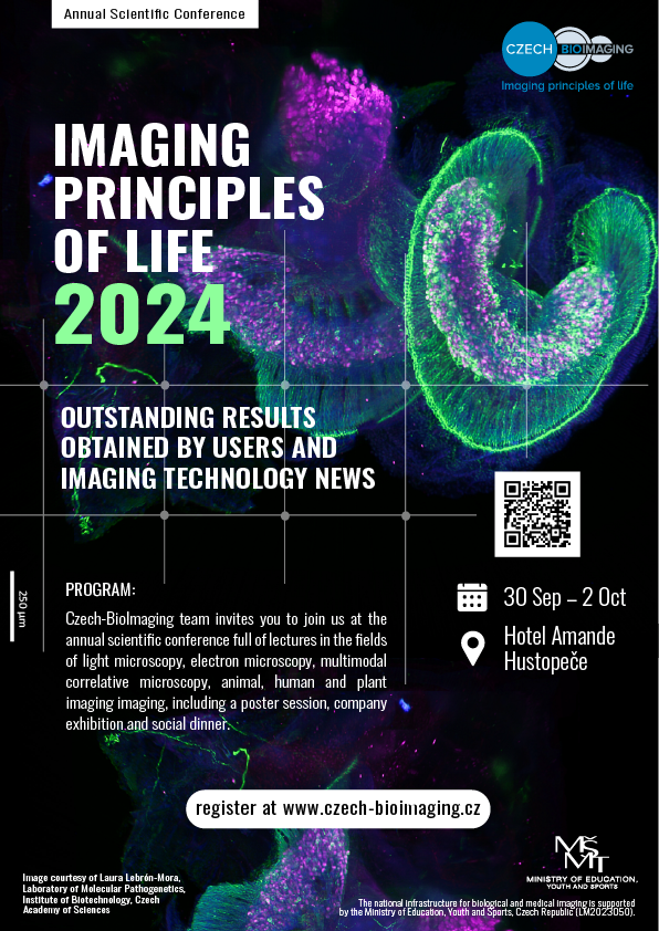 IMCF_BIOCEV's tweet photo. The #CzechBioimaging conference is just around the corner! You will find most of our team in Hustopeče from Monday to Wednesday and we are looking forward to tell you how to employ our microscopes in your research (while tasting Moravian wine). See you there! https://t.co/N59Q9LwvlF