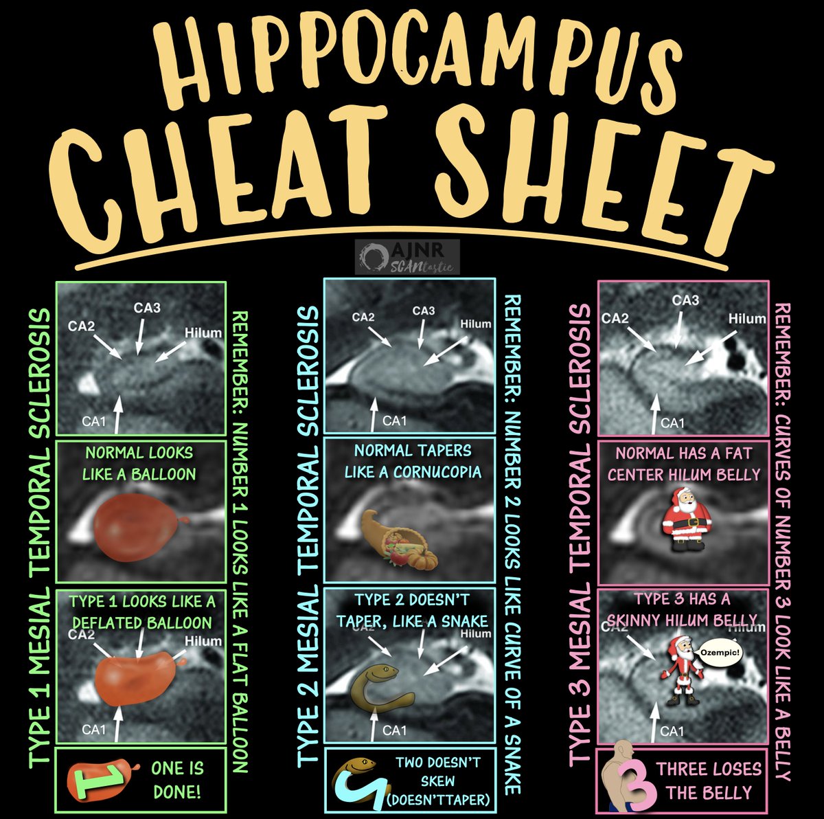 teachplaygrub's tweet image. Ready to seize the day w/epilepsy imaging?

Everyone knows mesial temporal sclerosis (MTS)! But did you know there are different KINDS of MTS??

This month's @theAJNR SCANtastic shows YOU what you need to know in the latest in epilepsy imaging!

ajnr.org/content/45/9/1…

Here's…