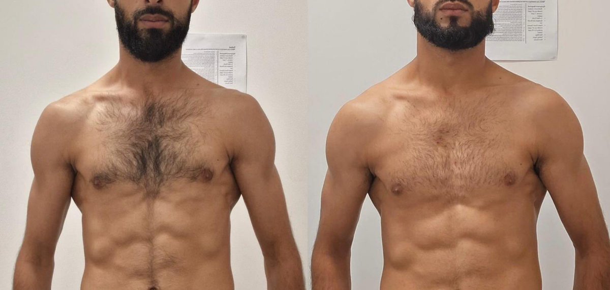 Stronger, bigger &amp; fuller without gaining any fat stores 🤝 you don’t need to be in a crazy surplus to gain more muscle, understand that it’s all about consistency and build your appetite up &amp; increase your intake accordingly to your weekly evidence &amp; feedback ✅