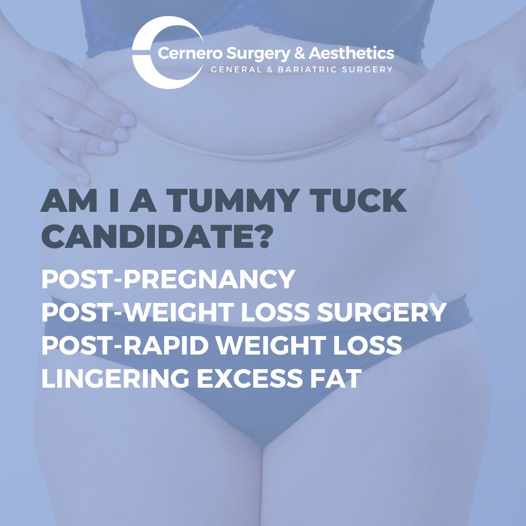 CerneroSurgery's tweet photo. Tummy Tuck surgery is not a weight loss procedure. The abdominoplasty procedure is recommended for patients who are generally in good health, but despite diet and exercise, have issues keeping off excess fat around the abdomen. If this sounds like you, let's talk! 903.462.4247 https://t.co/IrEwxsPc7F