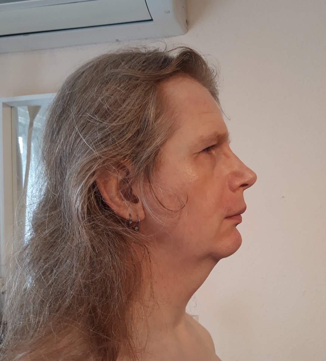 PropertyOfMyCat's tweet photo. Face reveal. This is my face now, after 2 years, 2 months and 25 days of HRT. No makeup or filters. Neutral facial expression. No spectacles. I see an old, ugly, worn-out, broken man, kinda scary-looking. 😞
1/2 https://t.co/xjBE9Fq1cN