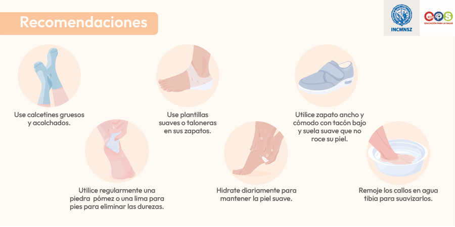 INCMNSZ_EPS's tweet photo. #Callosidades | Instituto Nacional de Ciencias Médicas y Nutrición Salvador Zubirán

#salud #medicina #callos #callosidades #calcetines #plantillas #zapatos #tacones #hidratación #taloneras #diabetes #pies #manos #piel #diabetes #circulación #cardiología #EPS #INCMNSZ https://t.co/tKCJQqXo3Y