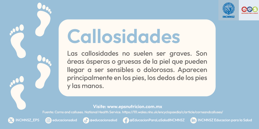 INCMNSZ_EPS's tweet photo. #Callosidades | Instituto Nacional de Ciencias Médicas y Nutrición Salvador Zubirán

#salud #medicina #callos #callosidades #calcetines #plantillas #zapatos #tacones #hidratación #taloneras #diabetes #pies #manos #piel #diabetes #circulación #cardiología #EPS #INCMNSZ https://t.co/tKCJQqXo3Y