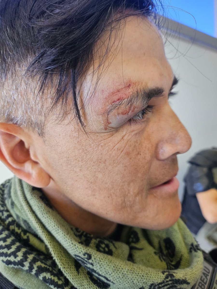 10 POLICÍAS HERIDOS POR LA VIOLENCIA DE UNTER

Lo que debía ser una manifestación se convirtió en un ataque violento que dejó a 10 policías rionegrinos heridos. Mientras intentaban proteger la <a href="/LegislaturaRN/">Legislatura de Río Negro</a> y garantizar la seguridad de todos, fueron brutalmente agredidos con