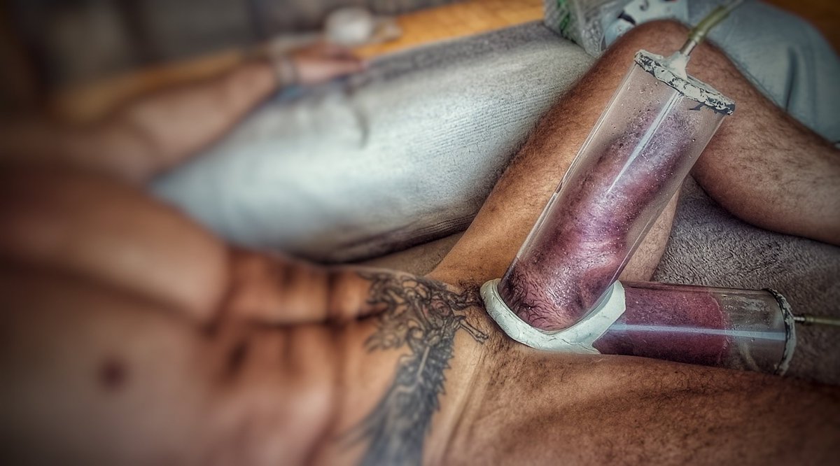 Its never enough.....

#pumped #pumpedcock #penispump #girth #fatdick #monstercock #vacuum #fetish #growing