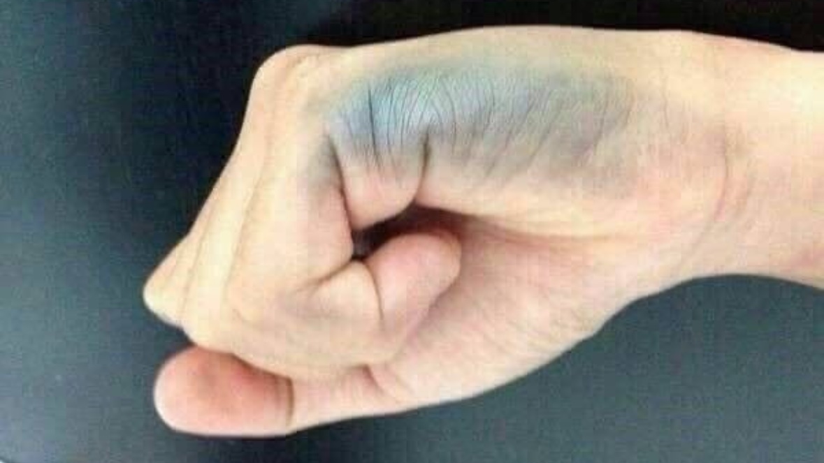 これなった事ある人いる？